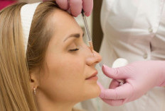Kenalan dengan Filler Hidung dan Manfaatnya yang Sering Terlewat