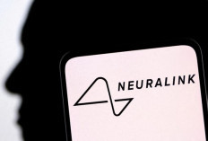Neuralink Elon Musk: 12 Orang di Dunia Sudah Pasang Implan Otak