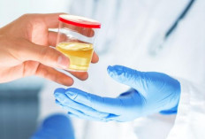 Waspada dari Warna hingga Tekstur, Urine Bisa Mengungkap Masalah Ginjal Sejak Dini