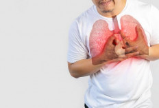  Kementerian Kesehatan Deteksi 889 Ribu Kasus Tuberkulosis pada 2024 hingga Maret 2025