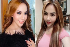Lisa Mariana Cerita Tentang Hidung  Tak Simetris dan Pengalaman Pribadinya