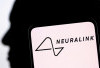 Neuralink Elon Musk: 12 Orang di Dunia Sudah Pasang Implan Otak