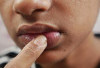 7 Penyebab Bibir Hitam yang Dapat Mengganggu Penampilan